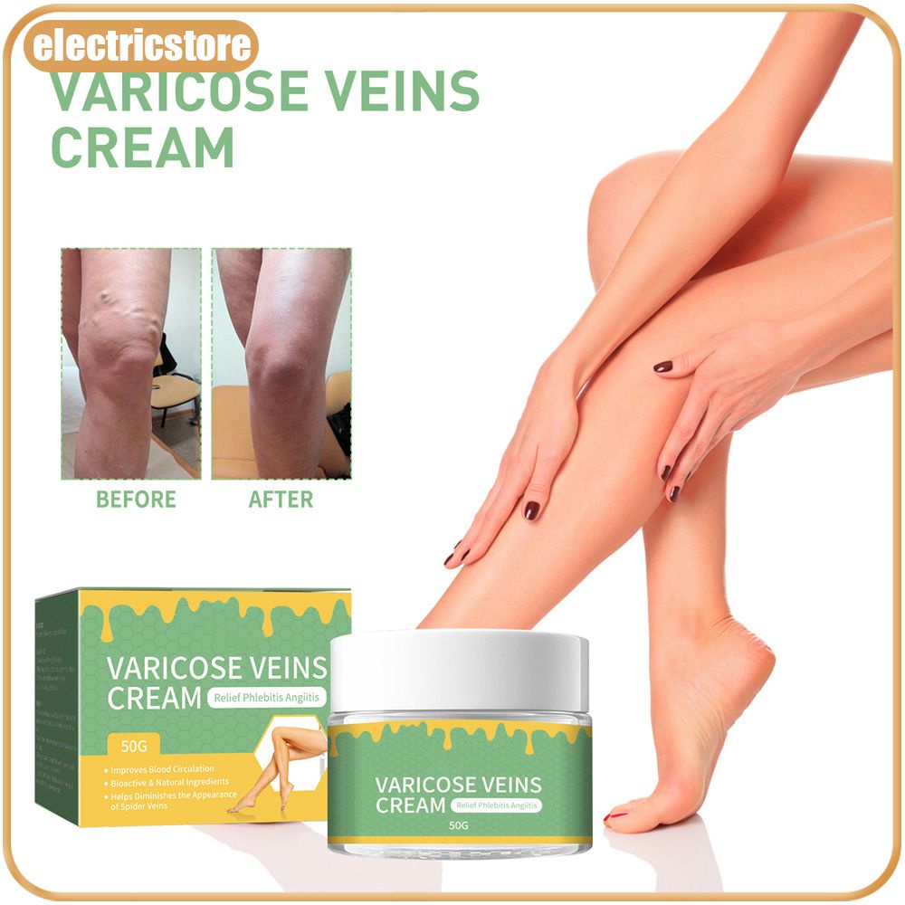 Crema Reparadora De Varicosas South Moon Alivia El Dolor De Piernas