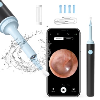 NATFIRE-Kit de limpieza de oídos NE3, palillos inteligentes para los oídos,  herramienta de eliminación de