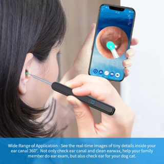  Eliminación de cera de cámara de oído, herramienta de limpieza  de oídos, limpiador de oídos con otoscopio de 1080p con luz, kit de  limpieza de oídos con 6 púas de oído