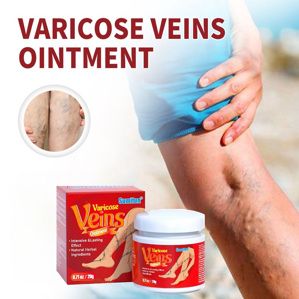 Crema De Alivio De Las Venas Varicosas Vasculitis Phlebitis Del Dolor ...