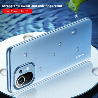 Carcasa Transparente Galvanizada Para Xiaomi Mi 11 Lite 5G NE Redmi Note 11  Pro 11s 10 10s 9s 9 Lente Protección Funda De Teléfono Suave TPU Cubierta